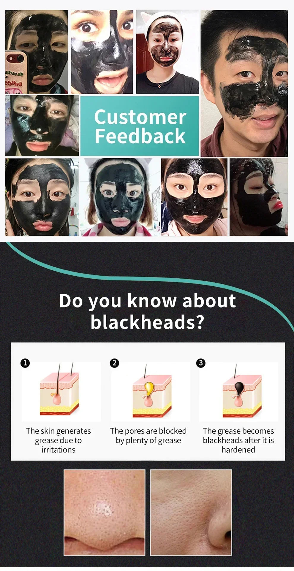 LANBENA Blackhead Remover Mask – Deep Pore Cleansing & Skin Brightening - Vitaléaa