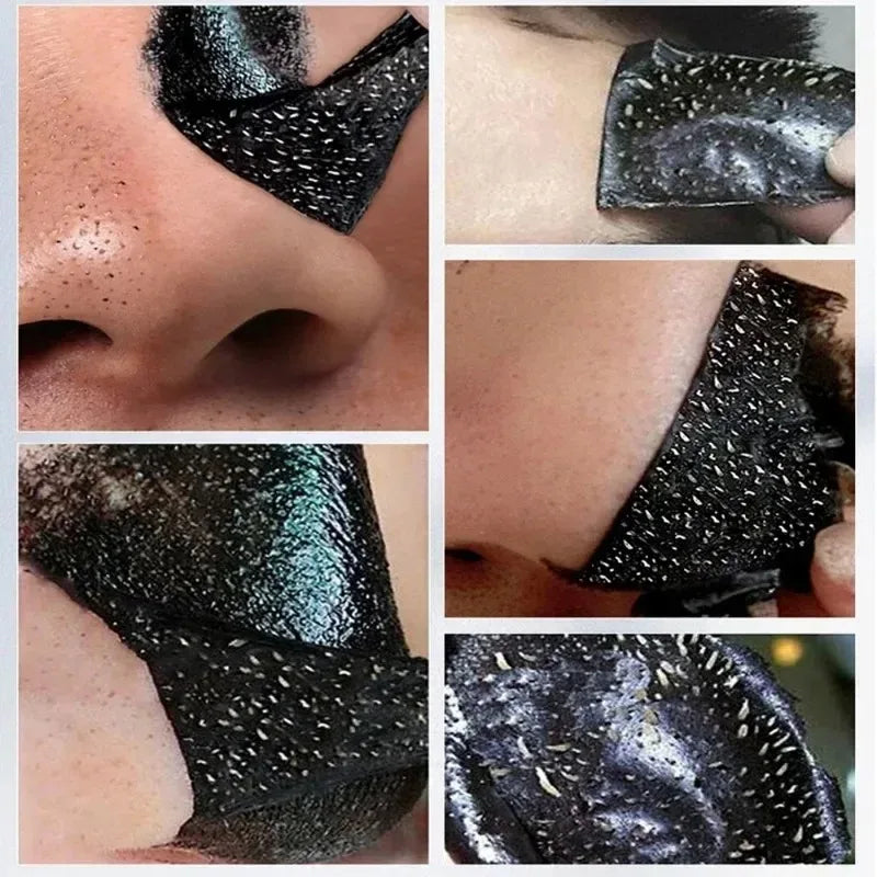 LANBENA Blackhead Remover Mask – Deep Pore Cleansing & Skin Brightening - Vitaléaa